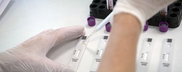 Экспресс-диагностика на антитела к коронавирусу в клинике Hadassah Medical Moscow в Сколково Экспресс-диагностика на антитела к коронавирусу в клинике Hadassah Medical Moscow в Сколково - Sputnik Аҧсны