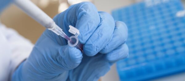 Разработка экспресс-тестов на коронавирус учеными из центра Сколково Разработка экспресс-тестов на коронавирус учеными из центра Сколково - Sputnik Аҧсны