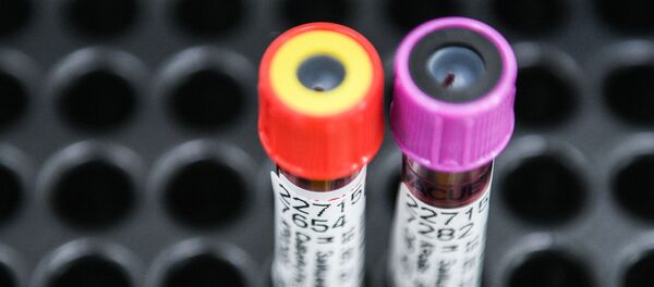 Тестирование россиян на наличие антител к COVID-19 Тестирование россиян на наличие антител к COVID-19 - Sputnik Абхазия