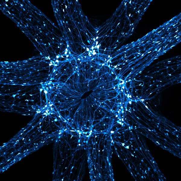 Снимок An in vivo snapshot of the neurons surrounding the mouth and tentacles of a juvenile starlet sea anemone американского фотографа Ruohan Zhong, занявший 16-е место в фотоконкурсе Nikon Small World 2021 - Sputnik Абхазия