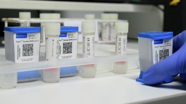 Медицинский работник держит в руке экспресс-тест на SARS-Cov 2 в лаборатории ПЦР в больнице Роберта Боша в Штутгарте, южная Германия - Sputnik Абхазия