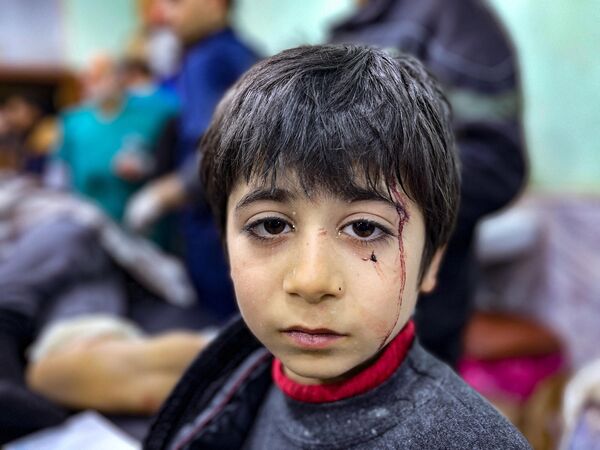 Раненый ребенок ожидает лечения в отделении неотложной помощи больницы Баб аль-Хава после землетрясения. - Sputnik Абхазия