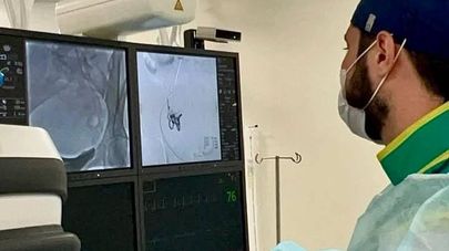 Малоинвазивную процедуру, эмболизацию маточных артерий, впервые выполнили в Республиканской больнице