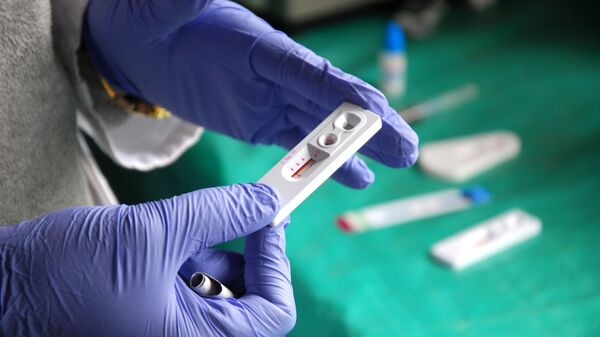 Лабораторный тест на ВИЧ - Sputnik Абхазия