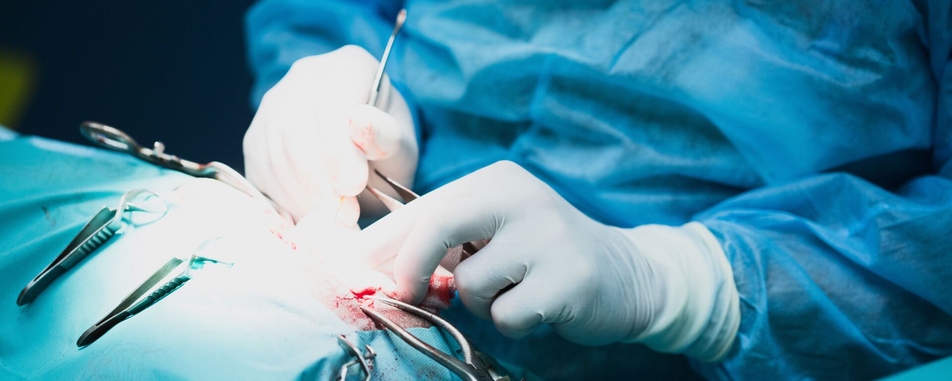 Хирург во время операции Хирург во время операции - Sputnik Абхазия, 1920, 21.01.2026