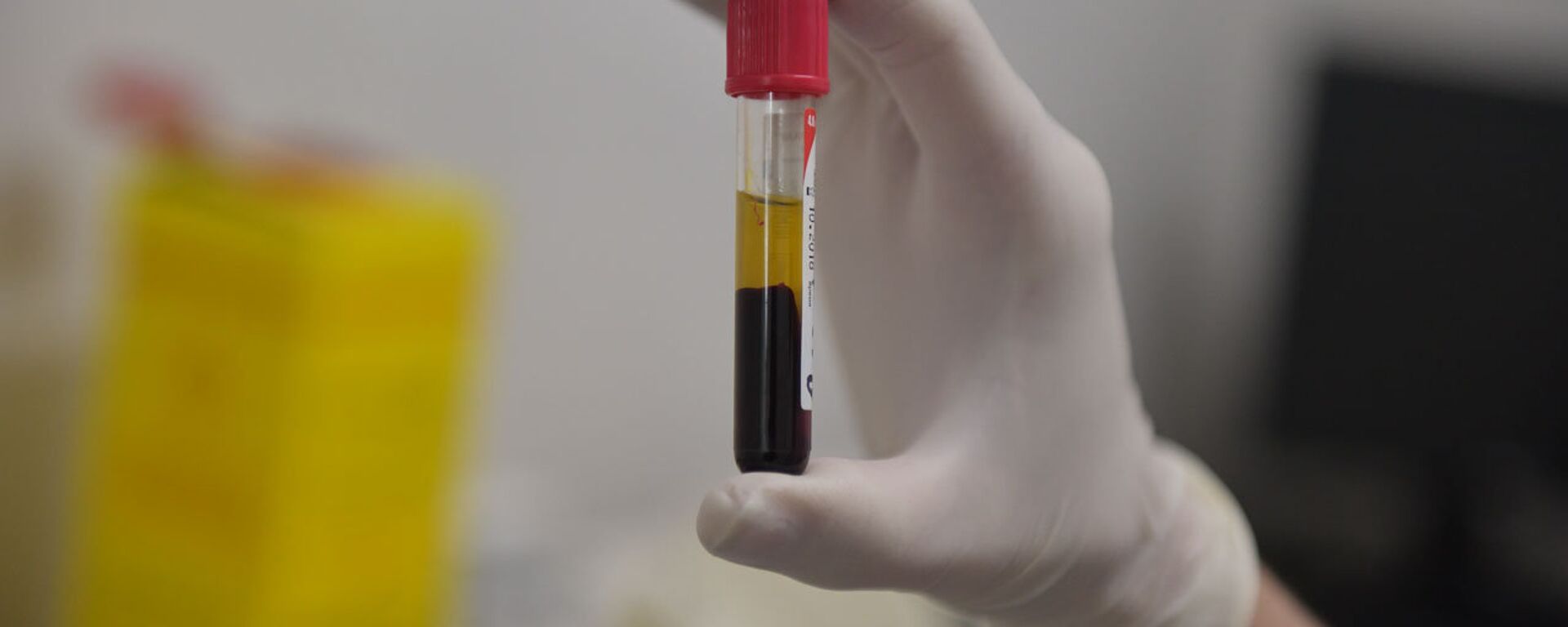 Республиканский противотуберкулезный диспансер  - Sputnik Абхазия, 1920, 19.02.2026