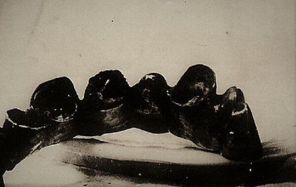 Сомнений, что это Гитлер, не было: история минского патологоанатома  - Sputnik Абхазия