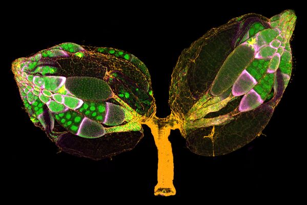 Снимок A pair of ovaries from an adult Drosophila female stained for F-actin (yellow) and nuclei (green); follicle cells are marked by GFP (magenta) американских фотографов Dr. Yujin Chen & Dr. Jocelyn McDonald, занявший 11 место в фотоконкурсе Nikon Small World 2019 - Sputnik Абхазия