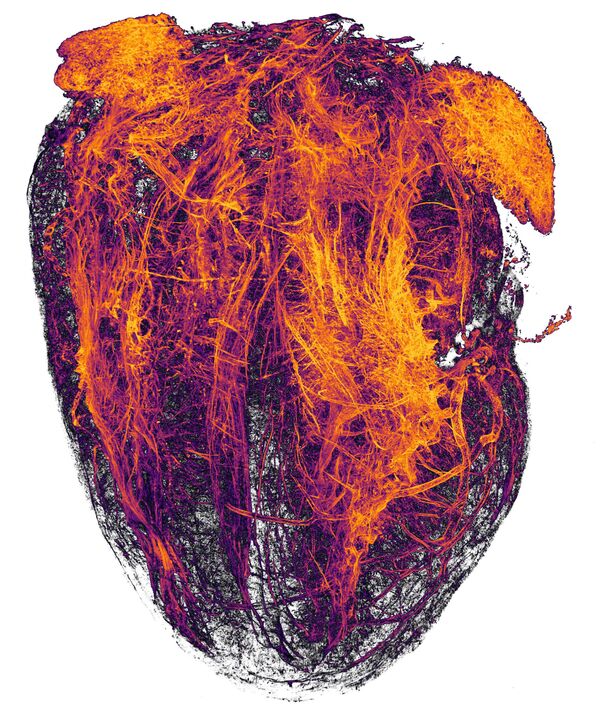 Снимок Blood vessels of a murine (mouse) heart following myocardial infarction (heart attack) фотографов Simon Merz, Lea Bornemann и Sebastian Korste , занявший 20 место в фотоконкурсе Nikon Small World 2019 - Sputnik Абхазия