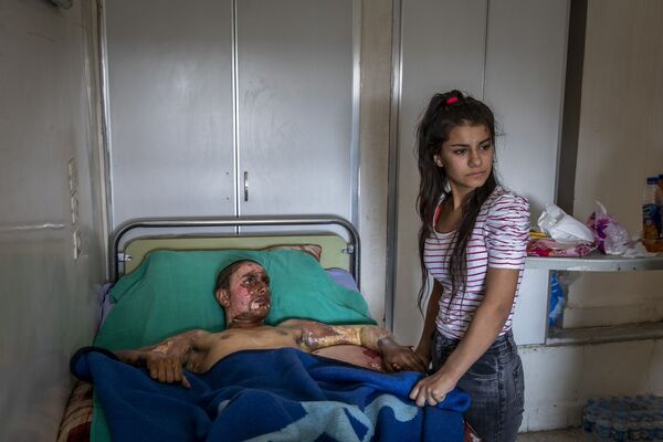 Снимок Injured Kurdish Fighter Receives Hospital Visit фотографа Ivor Prickett, номинант конкурса World Press Photo 2020 - Sputnik Абхазия
