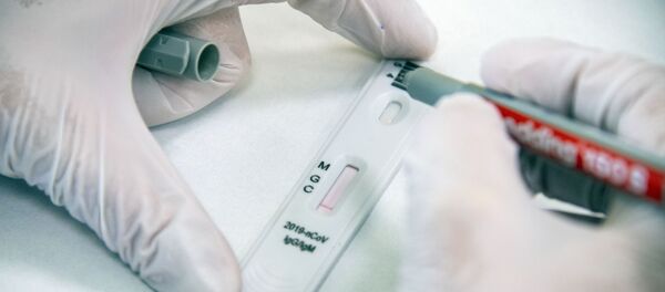 Экспресс-диагностика на антитела к коронавирусу в клинике Hadassah Medical Moscow в Сколково - Sputnik Аҧсны