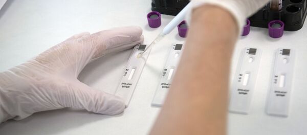 Экспресс-диагностика на антитела к коронавирусу в клинике Hadassah Medical Moscow в Сколково - Sputnik Абхазия