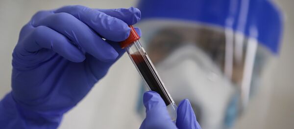 Тестирование на антитела к коронавирусу - Sputnik Аҧсны