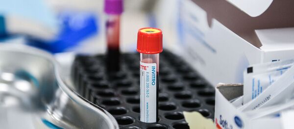 Тестирование россиян на наличие антител к COVID-19 Тестирование россиян на наличие антител к COVID-19 - Sputnik Аҧсны